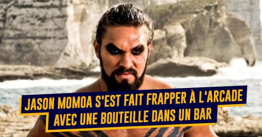 Top 14 des histoires derrière les cicatrices de célébrités