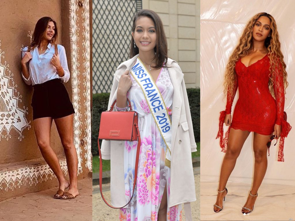 Top 15 des défauts physiques assumés par des stars